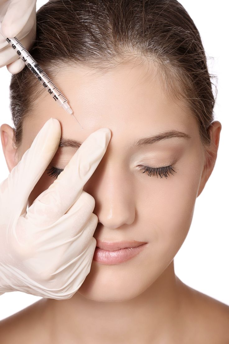 Injection d'agent de comblement: 1 seringue